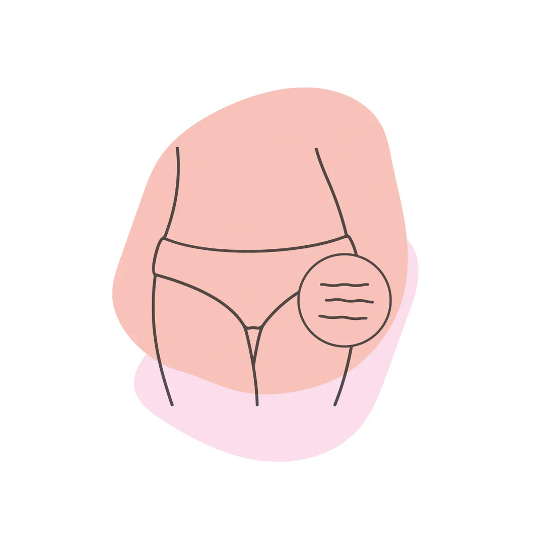 Imperfecțiuni Corporale