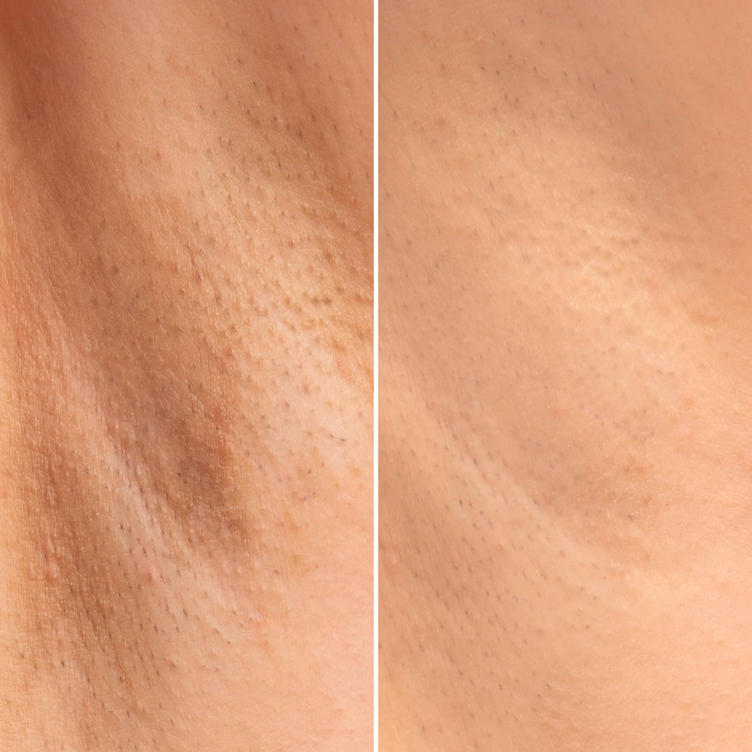 Crema Intimă Albitoare – Cremă intimă iluminatoare, hidratantă și albitoare | Eco Bio Boutique