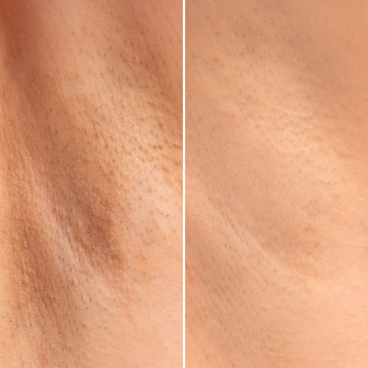 Crema Intimă Albitoare – Cremă intimă iluminatoare, hidratantă și albitoare | Eco Bio Boutique