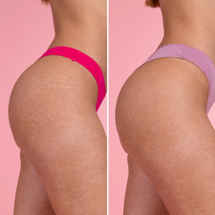 Rutina Antivergeturi – Elasticizează, Hrănește și Regenerează pielea | Eco Bio Boutique