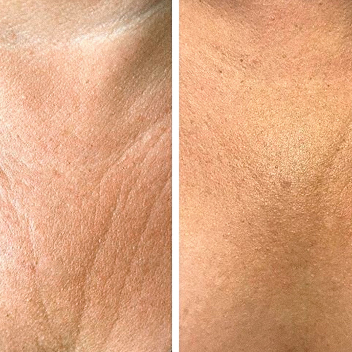 Crema Anti-rid pentru Gât și Decolteu – Efect Lifting, Umplere și Reafirmare | Eco Bio Boutique