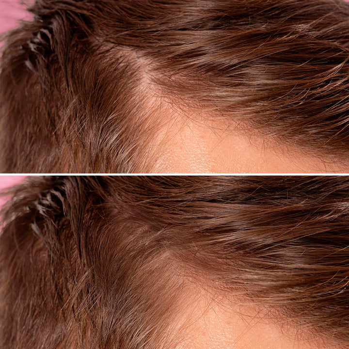 Hair Density Filler – Tratament Anti-cădere și Fortifiant pentru Păr | Eco Bio Boutique