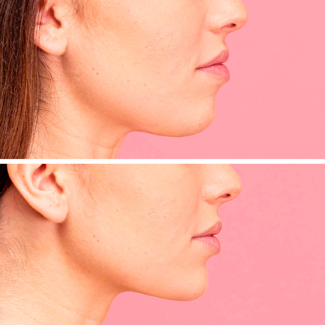 LiftUp – Gel fermizant și remodelant pentru bărbie | Eco Bio Boutique