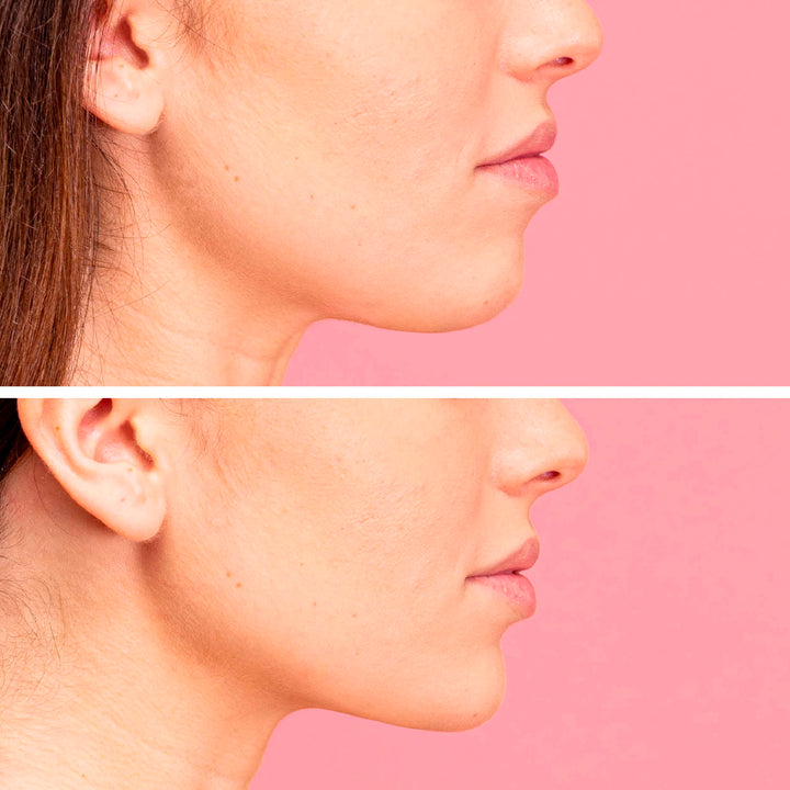 LiftUp – Gel fermizant și remodelant pentru bărbie | Eco Bio Boutique