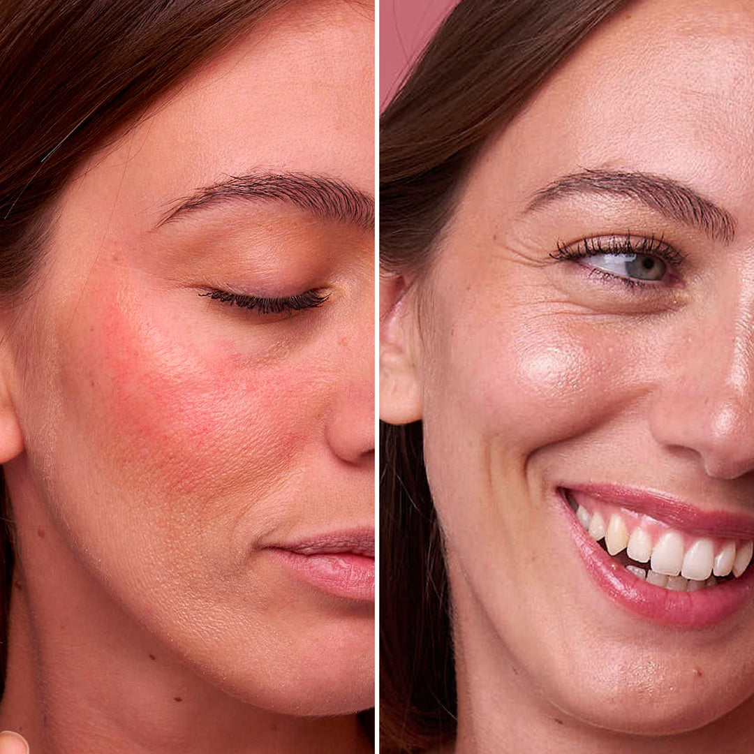 Rose – Ulei Facial Hidratant, Regenerator și Iluminator | Eco Bio Boutique